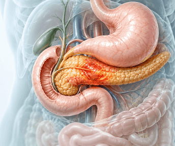 Pancreatitis