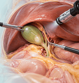 Advanced Laparoscopic Operation Theatre at Arihant Hospital