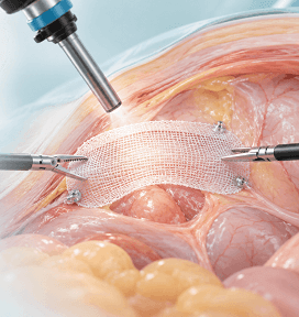 Advanced Laparoscopic Surgical Suite at Arihant Hospital