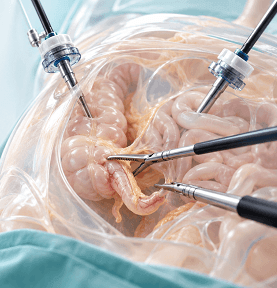 Advanced Laparoscopic Operation Theatre at Arihant Hospital