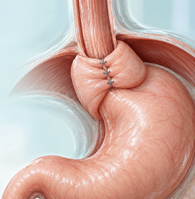 Advanced Laparoscopic Operation Theatre and Surgical Suite at Arihant Hospital